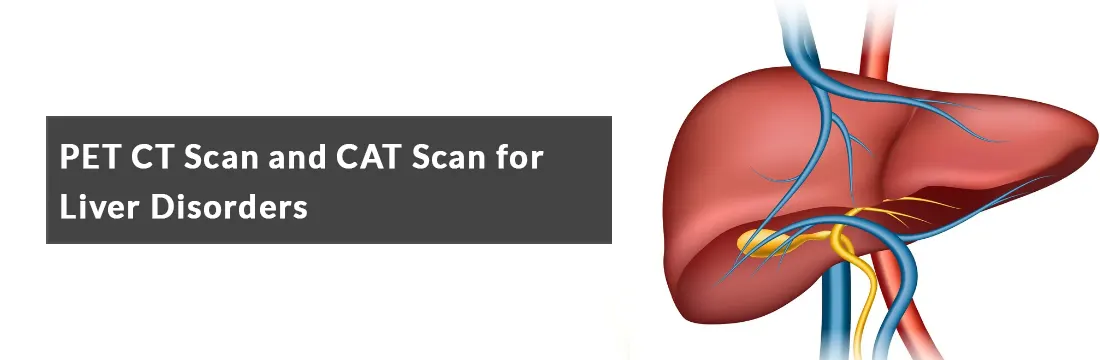 PET CT Scan and CAT Scan for Liver Disorders